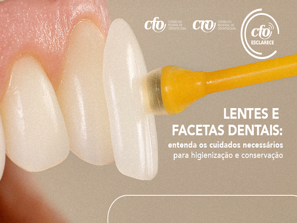 Facetas lentes dentais - 600 x 450