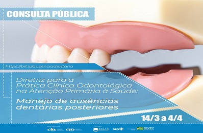 Consulta Pública dentárias posteriores - 398 x 260