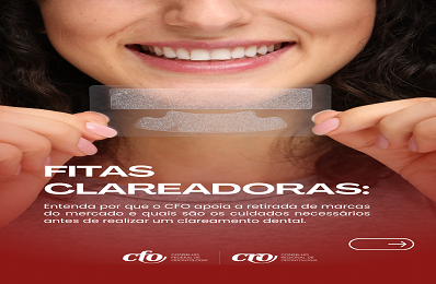 Fitas Clareadoras - Card 1 - 398 x 260