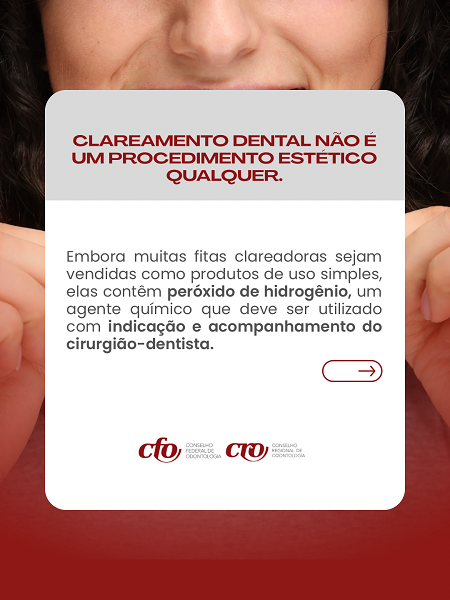 Fitas Clareadoras - Card 2