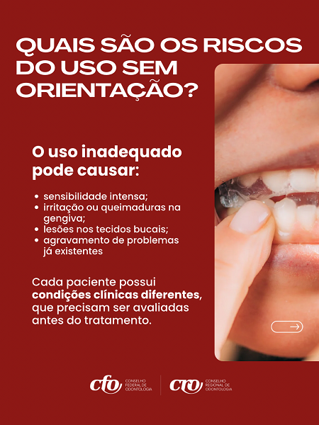 Fitas Clareadoras - Card 3