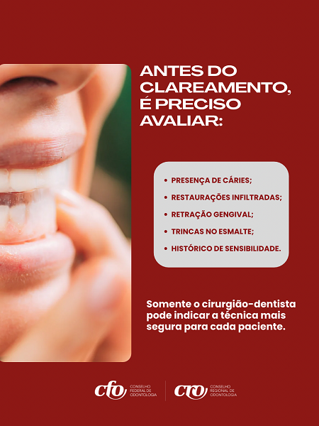 Fitas Clareadoras - Card 4