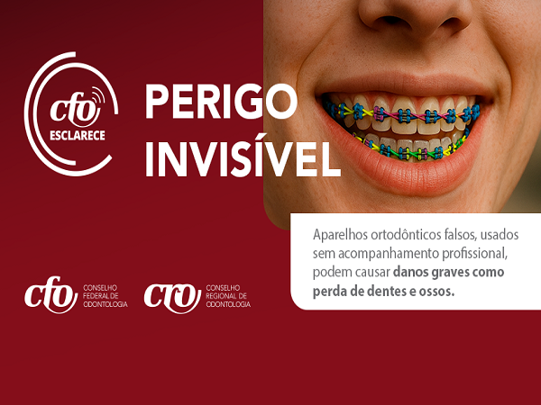 Aparelhos ortodônticos falsos - 600 x 450